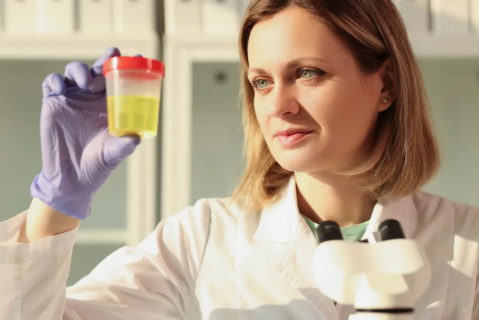 A stock image of a scientist examining a urine sample.