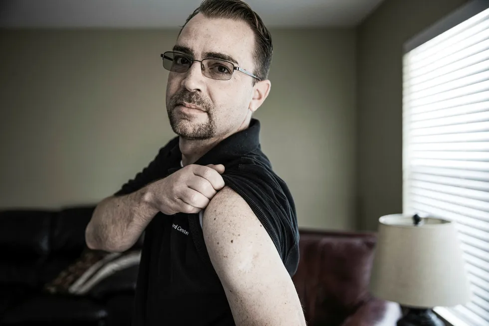 Var sjef for 50 mann. Ti heroinsprøyter om dagen har satt sine spor på Christopher Pierce overarmer.