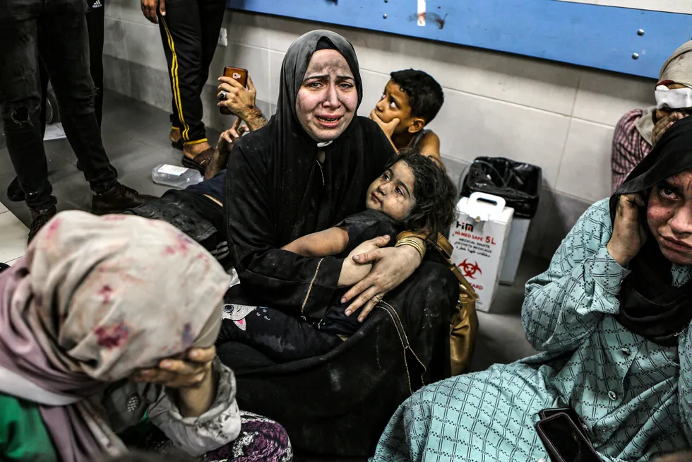 Sårede palestinere på Shifa-sykehuset etter angrepet på Al Ahli-sykehuset.