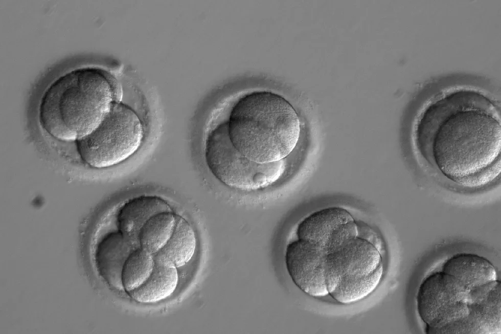 Forskerne ved Oregon Health & Science University lot de laboratorieskapte, redigerte embryoene utvikle seg noen få dager, inntil de utgjorde en håndfull celler. Foto: Oregon Health & Science University/AP/NTB Scanpix