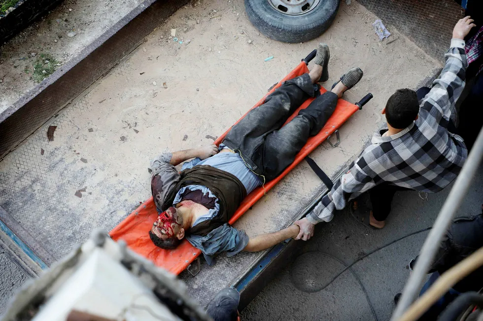TOPSHOT – A wounded Syrian man lies in the back of a pick up truck in Hazeh, in the rebel enclave of Eastern Ghouta on the outskirts of Damascus on March 15, 2018 following reported shelling by Syrian government forces. Seven years of conflict in Syria have left more than 350,000 people dead, according to an updated overall death toll released today by the Syrian Observatory for Human Rights. / AFP PHOTO / AMER ALMOHIBANY --- Foto: AMER ALMOHIBANY/AFP/NTB Scanpix