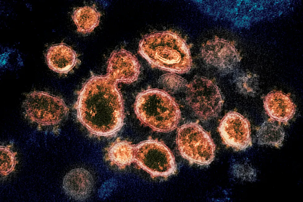 Challenging times: particles of the SARS-CoV-2 virus, which causes the potentially fatal Covid-19