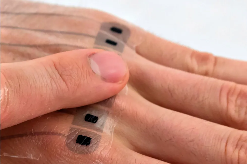 Tyske forskere har utviklet en e-tatovering som kan brukes som fjernkontroll til annen elektronikk. Bildet er bare en prototyp, endelige versjoner skal bli mer diskrete. Foto: Saarland Universität