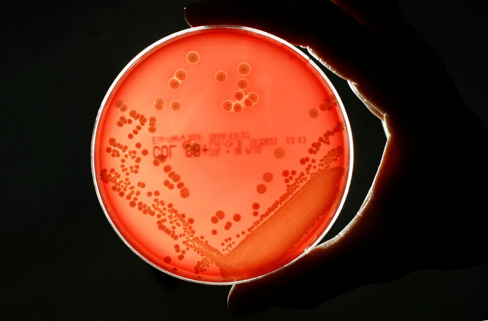 Klokken tikker i kampen mot antibiotikaresistente bakterier. På bildet MRSA-bakterie som har utviklet resistens mot alle penicilliner.REUTERS/Fabrizio Bensch (GERMANY) Foto: Fabrizio Bensch/Reuters/NTB scanpix