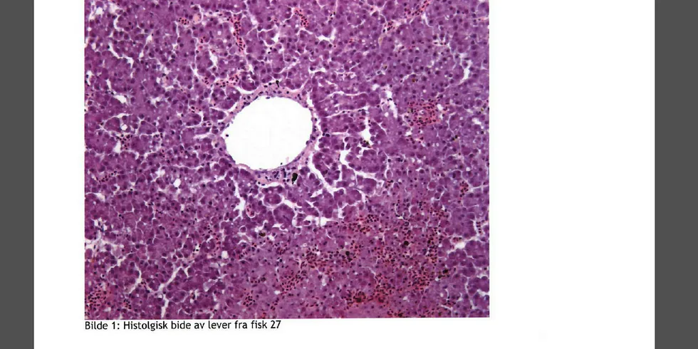 Deler av dokumentet: Histologisk bilde av leveren til fisk 27. Bildene viser forandringer i leveren som er forenelig med ILA, ifølge Veterinærinstituttet.