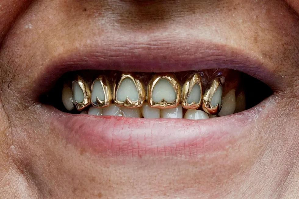 Gull i tennene er bare et av mange bruksområder for det edle metallet, som også brukes i blant annet smykker og elektronikk.