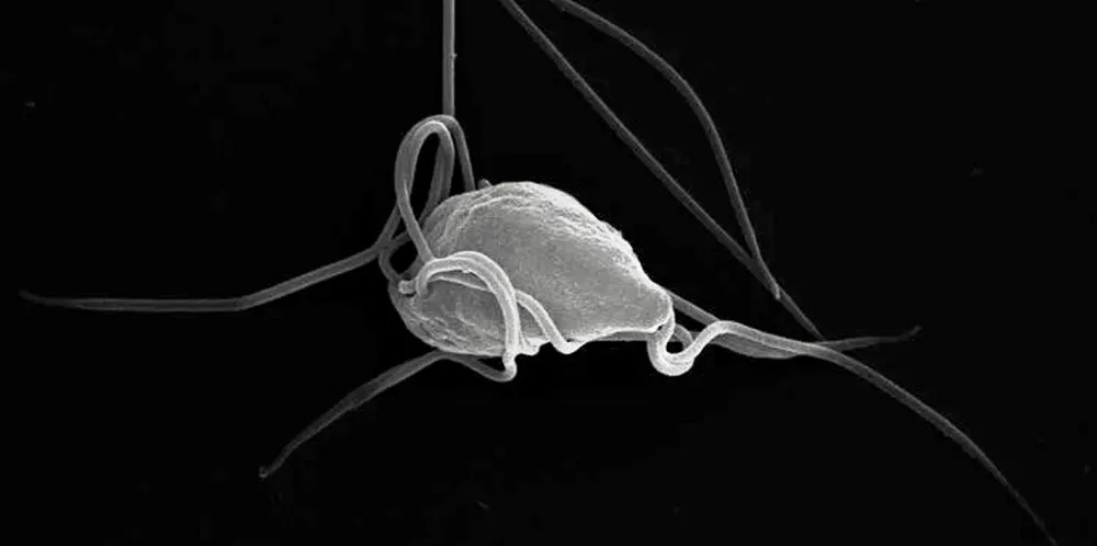 Small but deadly: Spironucleus salmonicida.
