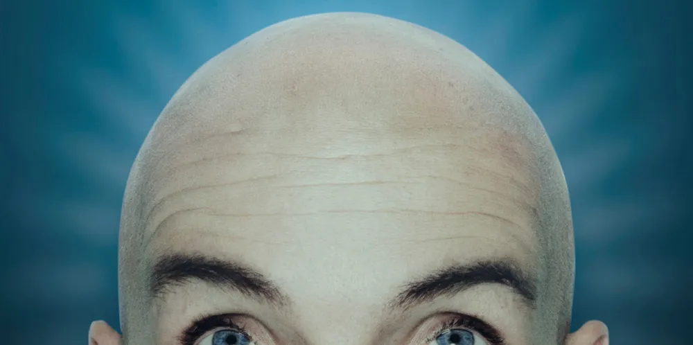 Baldies Intro. Baldies Intro.