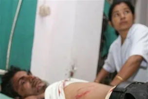 Wounded: one of the victims of the blasts that rocked GuwahatiPhoto:AP